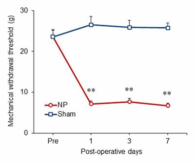 Inhibition of Mammalian Target of Rapamycin (mTOR) Signaling in the Insular Cortex Alleviates Neuropathic Pain after Peripheral Nerve Injury